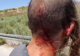 שבי שומרון: נער יהודי נפצע מאבן שזרקו ערבים